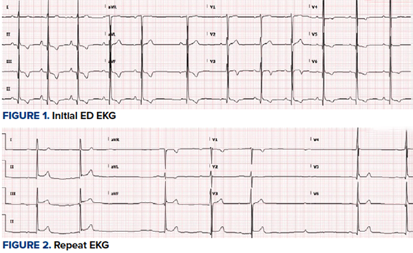 47-2 STEMI.png 47-2 STEMI.png