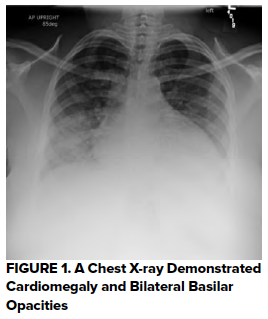 47-3 Atypical HUS - Figure 1.png