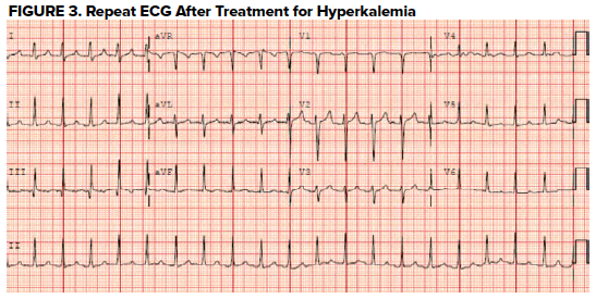 47-3 Atypical HUS - Figure 3.png