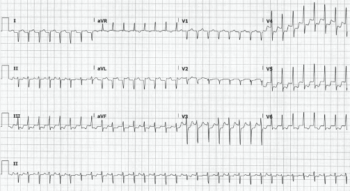 47-3 ECG Challenge.png