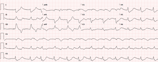 47-4 ECG Challenge 1.png