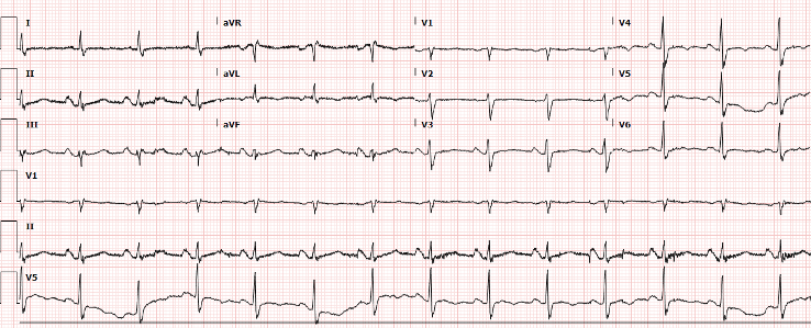 47-4 ECG Challenge 2.png