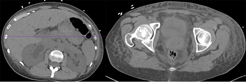 47-5 Cancer Renal Failure.jpg