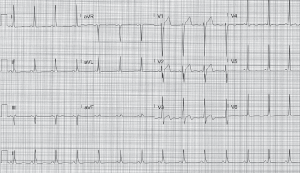 47-5 ECG Challenge.png