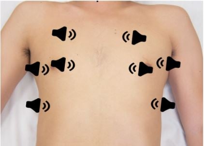 Lung POCUS - Figure 1.jpg