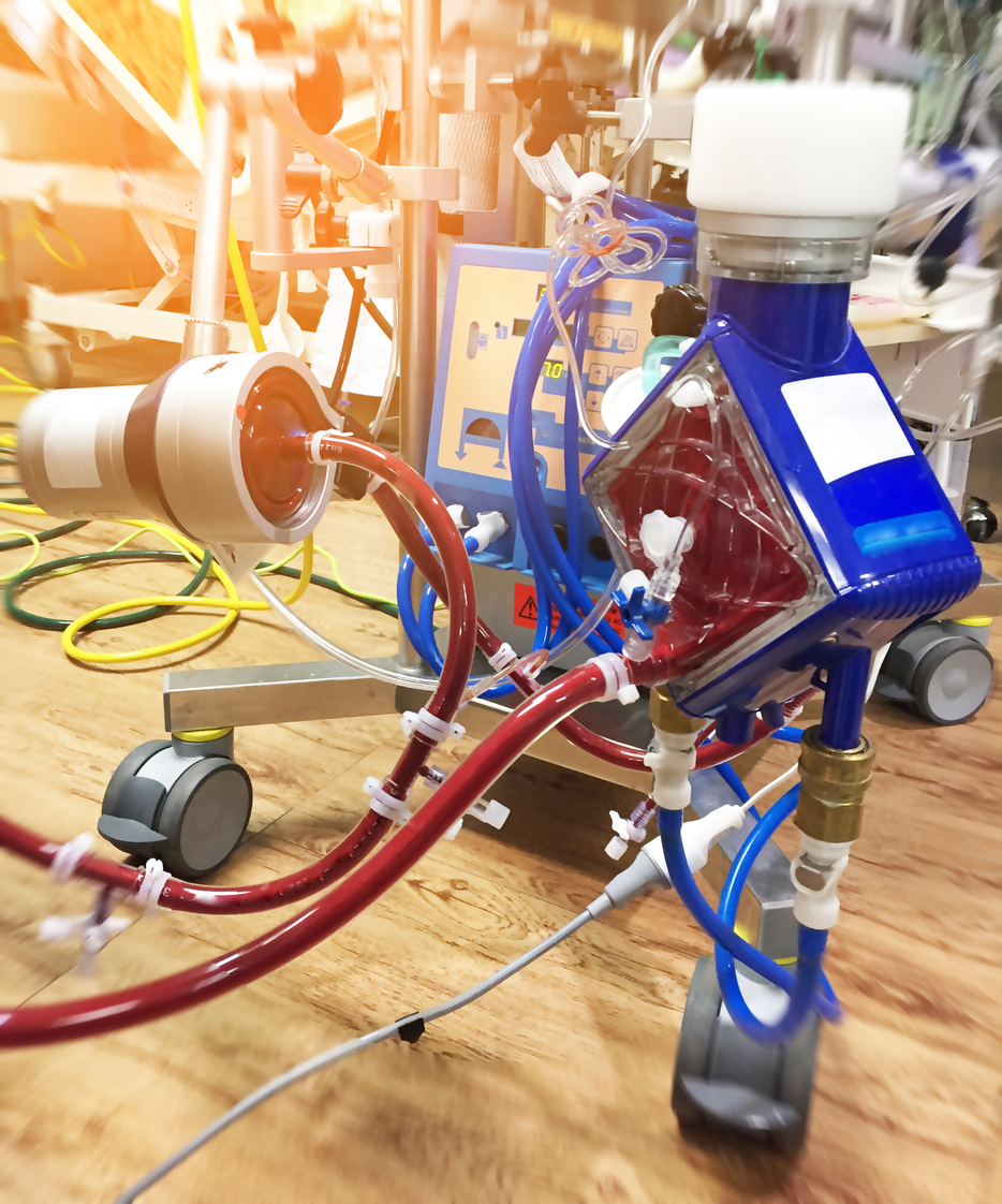CCA - ECMO CPR.jpg CCA - ECMO CPR.jpg