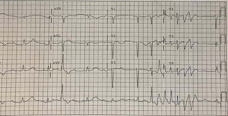 47-6 ECG Challenge - Dec-Jan2020.jpg