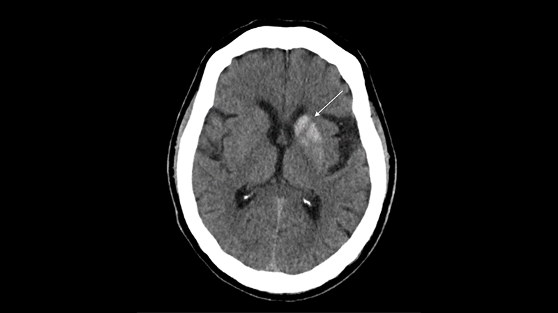 47-6 NHH Case Report - Figure 1.jpg