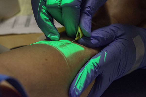 CCA - Peripheral IV for Vasopressors.jpg CCA - Peripheral IV for Vasopressors.jpg