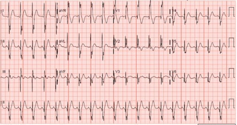 48-2 Blunt Cardiac Injury.jpg