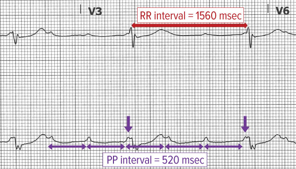 48-2 ECG Challenge Figure 1.jpg