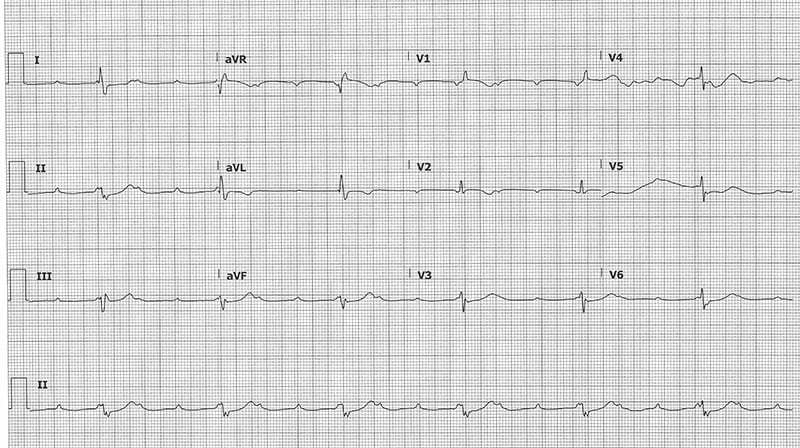 48-2 ECG Challenge.jpg