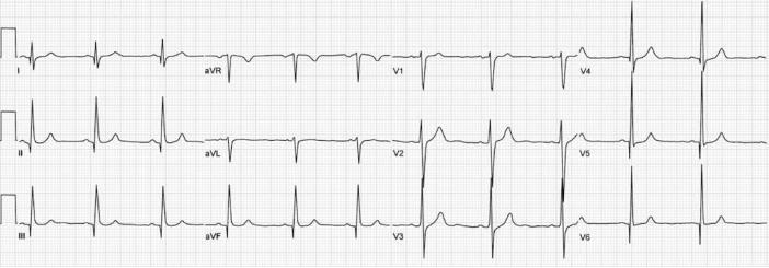 48-2 HOCM - Figure 3.png