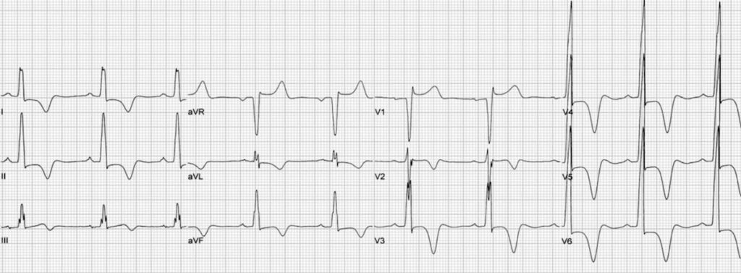 48-2 HOCM - Figure 4.png