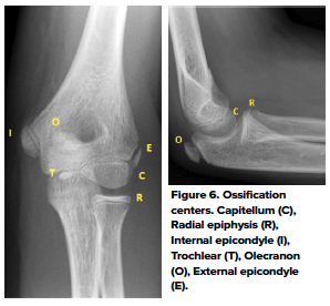 48-2 Ped Elbow 4.png