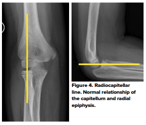 48-2 Ped Elbow 6.png