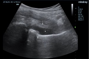 48-2 Ped Gonococcal Hip Fig 1.png
