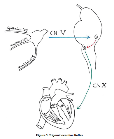 48-2 Trigeminocardiac Reflex Fig 1.png