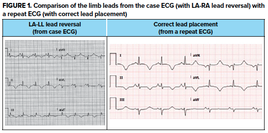 48-3 ECG Challenge Figure 1.png