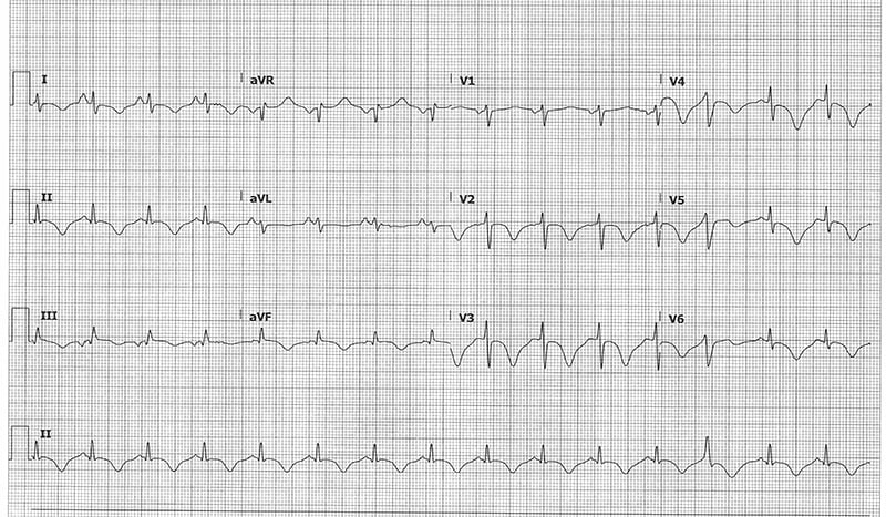 48-3 ECG Challenge initial.jpg