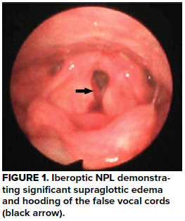 48-3 Laryngeal Injury Figure 1.png