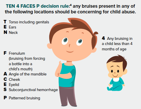 48-3 Pediatric Exam Ten 4 Faces P.png