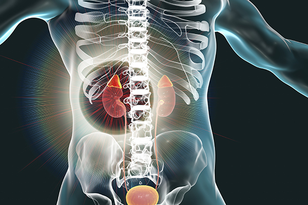 48-4 Bilateral Adrenal Hemorrhage.jpeg