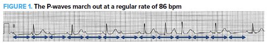 48-4 ECG Challenge Answer Fig 1.png