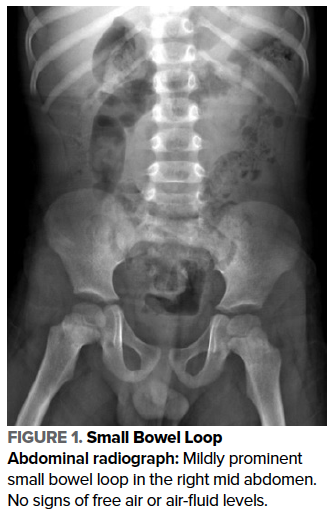 48-4 Pediatric Acute Abdomen Fig 1.png