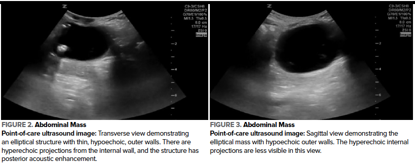 48-4 Pediatric Acute Abdomen Fig 2-3.png