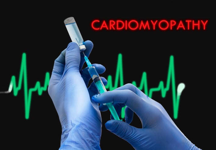48-4 Septic Cardiomyopathy.jpg 48-4 Septic Cardiomyopathy.jpg