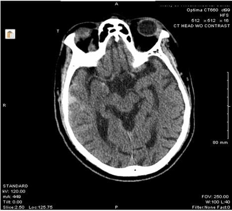 48-4 Unusual Tachycardia Image 1.jpeg