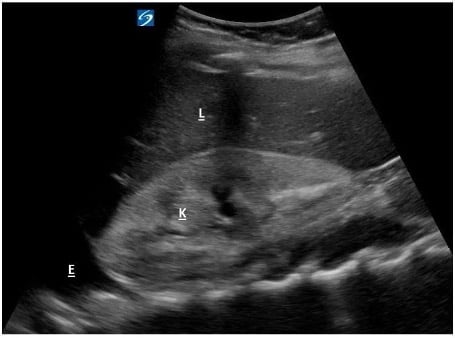 POCUS FTW FSG 1.jpg