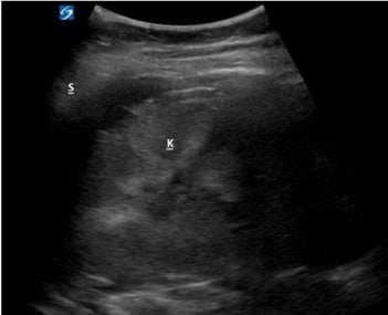 POCUS FTW FSG 3.jpg