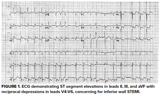 48-5 POC Echo Fig 1.png