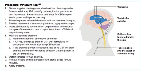 Ventriculoperitoneal Shunt in the ED EMRA