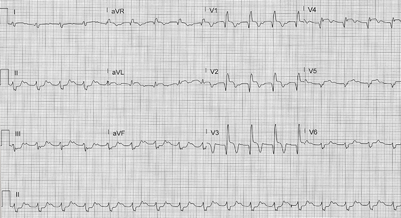 49-2 ECG Challenge - case ECG.jpg