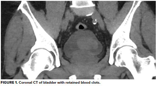 49-2 Hematuria Fig 1.png