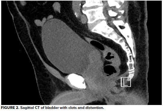 49-2 Hematuria Fig 2.png