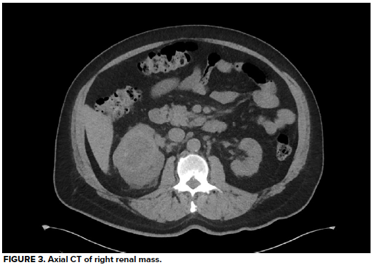 49-2 Hematuria Fig 3.png