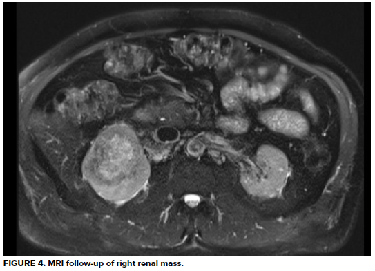 49-2 Hematuria Fig 4.png