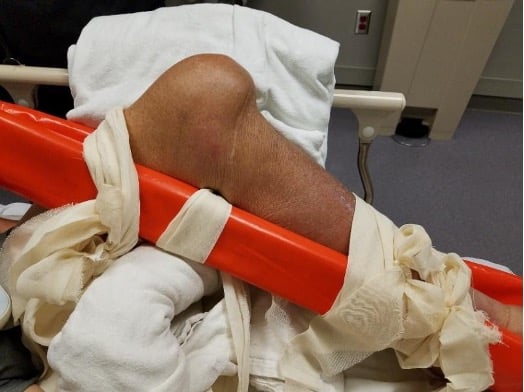 TotalKneePicture2.jpg