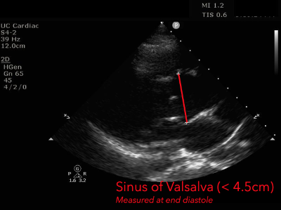 Speedy Flap - Brasil Medical