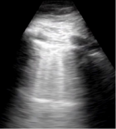 Prehospital SoB Figure 3.jpg