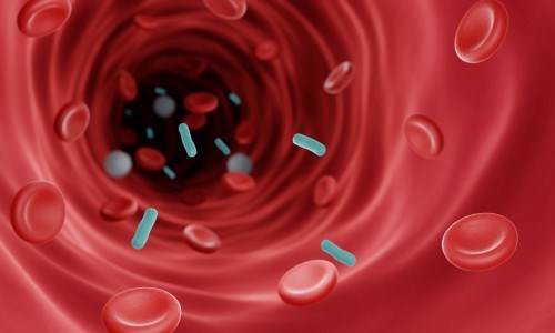 Toxic shock syndrome - WikEM