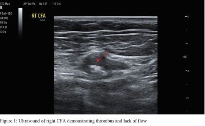 Aortic Figure 1.jpeg