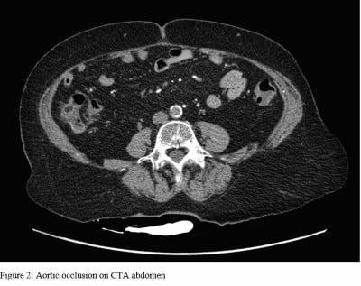 Aortic Figure 2.jpeg