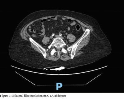 Aortic Figure 3.jpeg