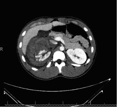 Kidney Figure 2.jpg