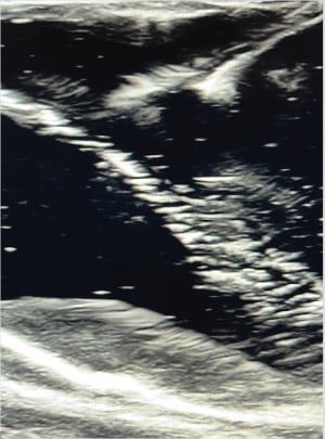 POCUS Figure 10.jpg